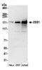 Zinc Finger E-Box Binding Homeobox 1 antibody, A301-921A, Bethyl Labs, Western Blot image 