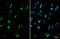Polypeptide N-acetylgalactosaminyltransferase 3 antibody, GTX131628, GeneTex, Immunocytochemistry image 