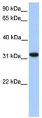 Electron transfer flavoprotein subunit alpha, mitochondrial antibody, TA336248, Origene, Western Blot image 
