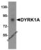 DYRK1A antibody, 6255, ProSci Inc, Western Blot image 