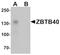 Zinc Finger And BTB Domain Containing 40 antibody, orb75809, Biorbyt, Western Blot image 