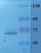 Toll Like Receptor 2 antibody, orb191498, Biorbyt, Western Blot image 