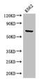 Beta-Transducin Repeat Containing E3 Ubiquitin Protein Ligase antibody, CSB-PA897464LA01HU, Cusabio, Western Blot image 