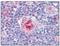 Intercellular Adhesion Molecule 1 antibody, AM08311PU-N, Origene, Immunohistochemistry frozen image 