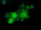 Phosphoribosylaminoimidazole Carboxylase And Phosphoribosylaminoimidazolesuccinocarboxamide Synthase antibody, TA501485, Origene, Immunofluorescence image 