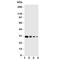 Leukocyte tyrosine kinase receptor antibody, R31096, NSJ Bioreagents, Western Blot image 