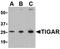TP53 Induced Glycolysis Regulatory Phosphatase antibody, orb74806, Biorbyt, Western Blot image 