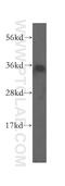 Sulfotransferase Family 1B Member 1 antibody, 16050-1-AP, Proteintech Group, Western Blot image 