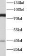 Bardet-Biedl Syndrome 7 antibody, FNab00823, FineTest, Western Blot image 