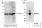 Proteasome 26S Subunit, Non-ATPase 7 antibody, A303-828A, Bethyl Labs, Western Blot image 