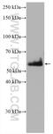 S protein antibody, 27953-1-AP, Proteintech Group, Western Blot image 