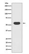 Mothers against decapentaplegic homolog 1 antibody, M00728, Boster Biological Technology, Western Blot image 