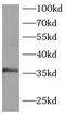 Linker For Activation Of T Cells antibody, FNab10030, FineTest, Western Blot image 
