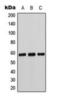 Cytochrome P450 Family 11 Subfamily B Member 1 antibody, orb224161, Biorbyt, Western Blot image 
