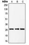 PTTG1 Regulator Of Sister Chromatid Separation, Securin antibody, LS-C353139, Lifespan Biosciences, Western Blot image 