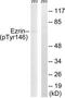 Ezrin antibody, TA326157, Origene, Western Blot image 