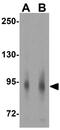 Toll Like Receptor 4 antibody, GTX31675, GeneTex, Western Blot image 