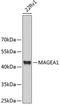 Melanoma-associated antigen 1 antibody, A03570-1, Boster Biological Technology, Western Blot image 