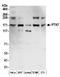 Protein Tyrosine Kinase 7 (Inactive) antibody, A304-452A, Bethyl Labs, Western Blot image 