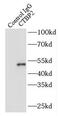 C-terminal-binding protein 2 antibody, FNab02047, FineTest, Immunoprecipitation image 