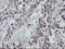 Mitochondrial Ribosomal Protein S27 antibody, LS-C175193, Lifespan Biosciences, Immunohistochemistry paraffin image 