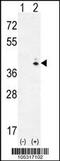 Galactokinase antibody, 62-645, ProSci, Western Blot image 