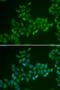Carnitine O-Acetyltransferase antibody, LS-C334663, Lifespan Biosciences, Immunofluorescence image 