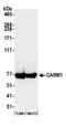Histone-arginine methyltransferase CARM1 antibody, A300-421A, Bethyl Labs, Western Blot image 