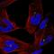 Centrosomal protein of 290 kDa antibody, HPA064397, Atlas Antibodies, Immunofluorescence image 