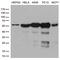 Serine/threonine-protein phosphatase 2B catalytic subunit alpha isoform antibody, M03026-1, Boster Biological Technology, Western Blot image 