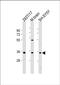N-Acetyltransferase 8 Like antibody, PA5-49536, Invitrogen Antibodies, Western Blot image 