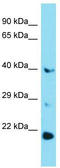 Glucose-6-Phosphatase Catalytic Subunit 3 antibody, TA337754, Origene, Western Blot image 
