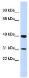 Zinc Finger Protein 660 antibody, TA345595, Origene, Western Blot image 