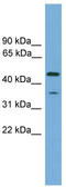 Leucine Rich Repeat Containing 73 antibody, TA334936, Origene, Western Blot image 