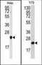 HCNP antibody, AP15047PU-N, Origene, Western Blot image 