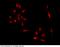 Mme antibody, 10266-T10, Sino Biological, Immunohistochemistry paraffin image 