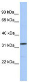 Sprouty RTK Signaling Antagonist 3 antibody, TA339689, Origene, Western Blot image 