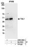 T-cell acute lymphocytic leukemia protein 1 antibody, A305-300A, Bethyl Labs, Immunoprecipitation image 