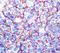 Chondroitin Sulfate Proteoglycan 4 antibody, LS-C348519, Lifespan Biosciences, Immunohistochemistry paraffin image 