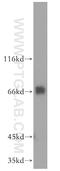Factor Interacting With PAPOLA And CPSF1 antibody, 12276-1-AP, Proteintech Group, Western Blot image 