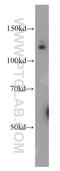 RB Binding Protein 8, Endonuclease antibody, 12624-1-AP, Proteintech Group, Western Blot image 