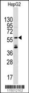 Angel Homolog 2 antibody, 61-480, ProSci, Western Blot image 