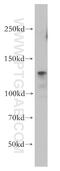Integrin Subunit Beta 1 antibody, 12594-1-AP, Proteintech Group, Western Blot image 