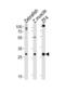 Adenylate Kinase 2 antibody, LS-C344709, Lifespan Biosciences, Western Blot image 