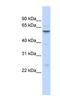 Insulin Like Growth Factor Binding Protein Acid Labile Subunit antibody, NBP1-59141, Novus Biologicals, Western Blot image 