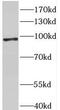 DNA replication licensing factor MCM8 antibody, FNab05063, FineTest, Western Blot image 