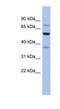 Glycyl-TRNA Synthetase antibody, NBP1-54602, Novus Biologicals, Western Blot image 