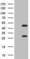 Nuclear Receptor Subfamily 1 Group I Member 3 antibody, MA5-26713, Invitrogen Antibodies, Western Blot image 