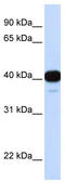 Forkhead Box L1 antibody, TA344508, Origene, Western Blot image 