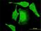 Poly(A) Specific Ribonuclease Subunit PAN2 antibody, H00009924-M01, Novus Biologicals, Immunofluorescence image 